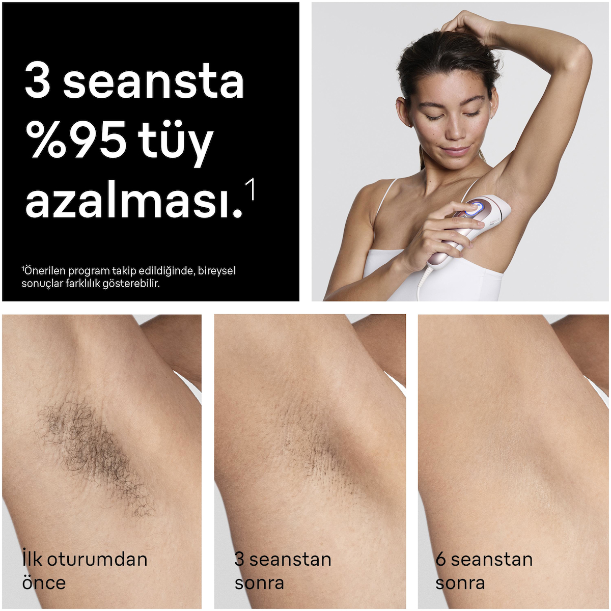 Braun IPL Skin i·expert, Evde Lazerle Tüy Alma, Ücretsiz Uygulama, Çanta, Venus Tıraş Makinesi, 3 Başlık, PL7321