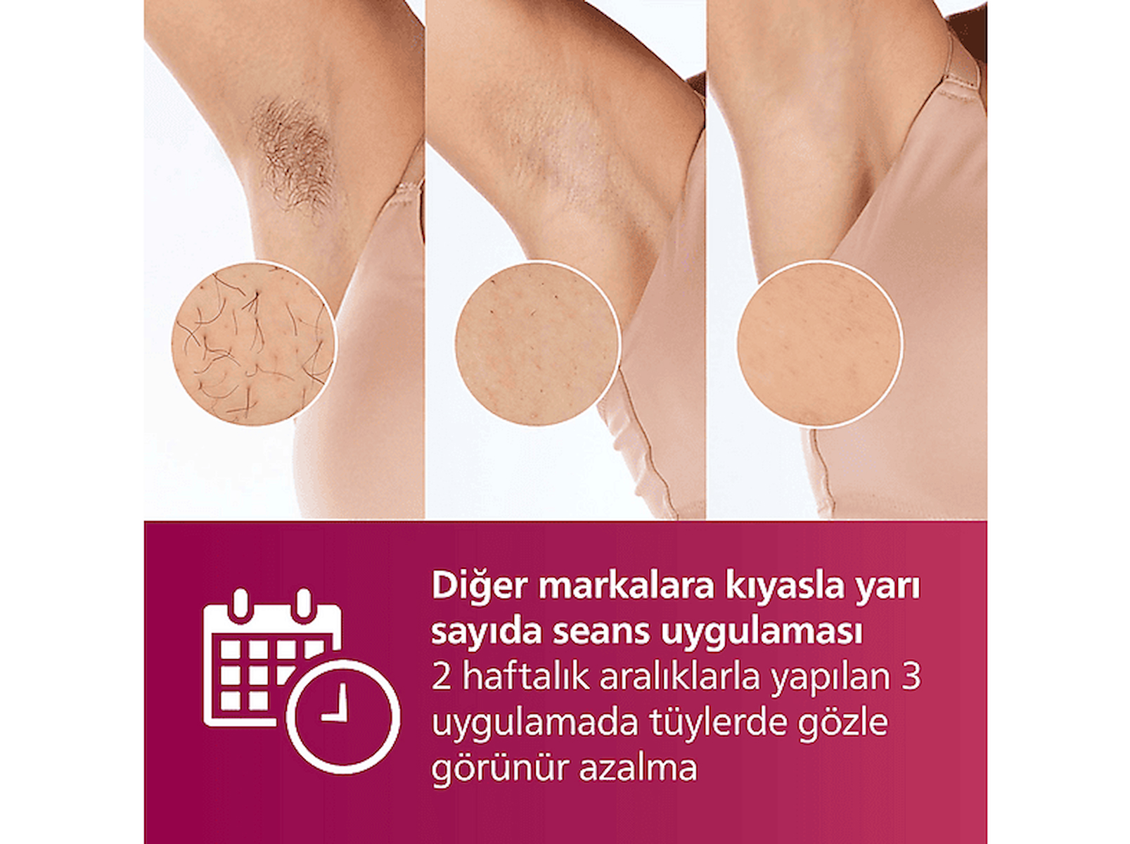 PHILIPS Lumea BRI924/00 Lazer IPL Cihazı