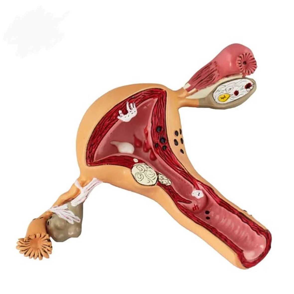 Uterus Pelvik Taban Maketi Model 41