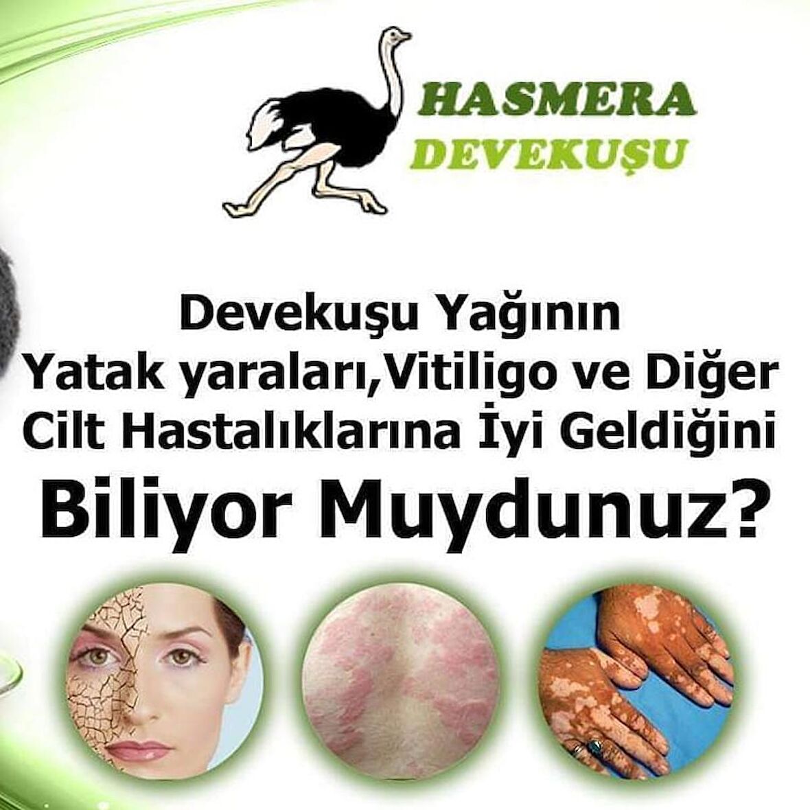 Toptan Devekuşu Yağı