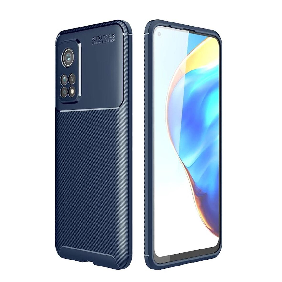 Gpack Xiaomi Mİ 10T Pro Kılıf Negro Karbon Dizayn Silikon