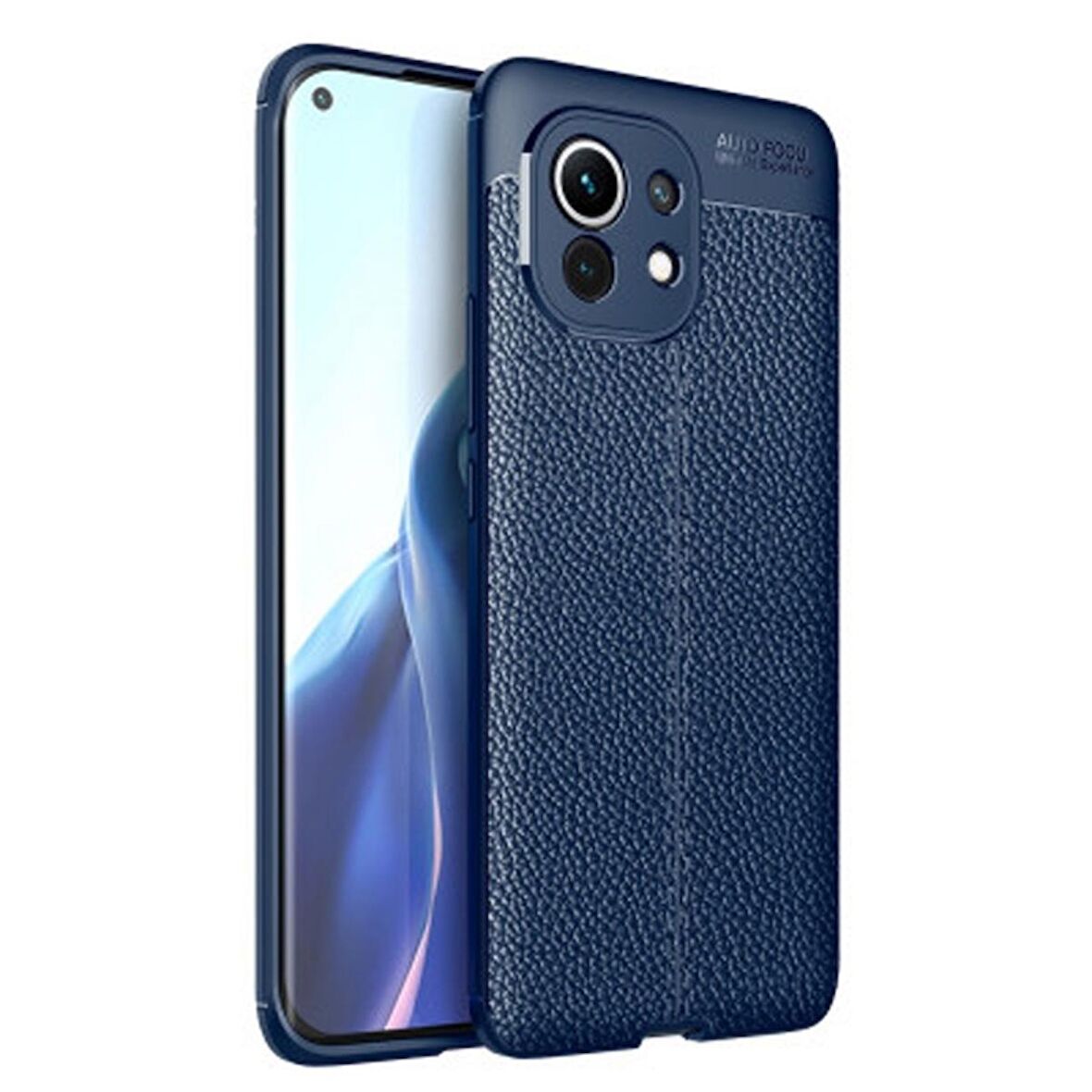 Gpack Xiaomi Mi 11 Kılıf Niss Silikon Deri Görünümlü