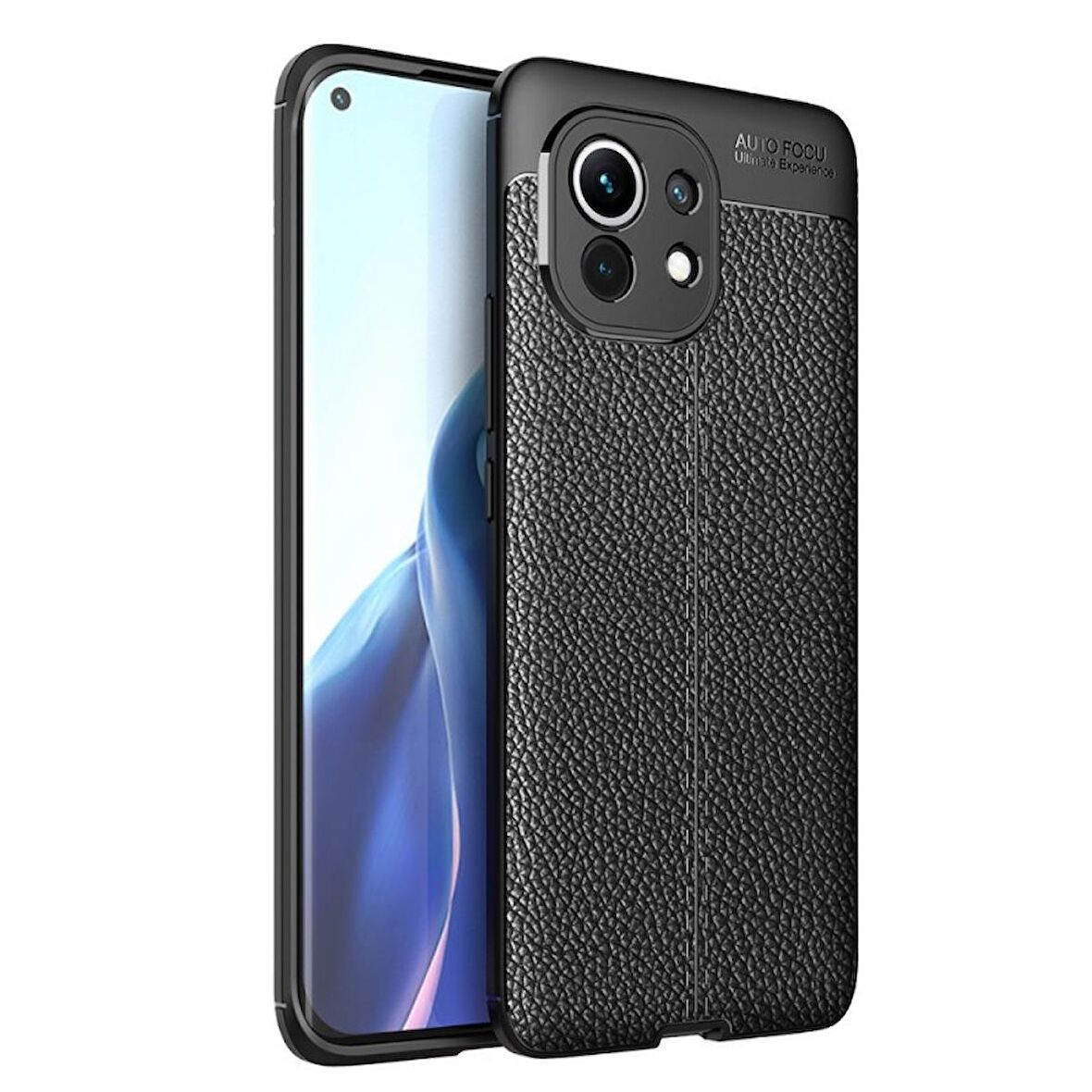 Smcase Xiaomi Mi 11 Kılıf Lüks Kamera Korumalı Deri Dokulu Silikon  Tam Kapatan Ekran Koruyucu