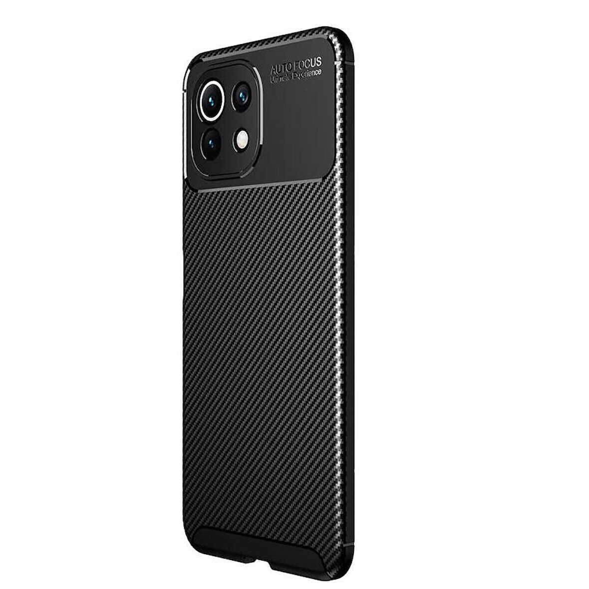 Smcase Xiaomi Mi 11 Lite Kılıf Kamera Korumalı Negro Darbeye Dayanıklı Silikon 