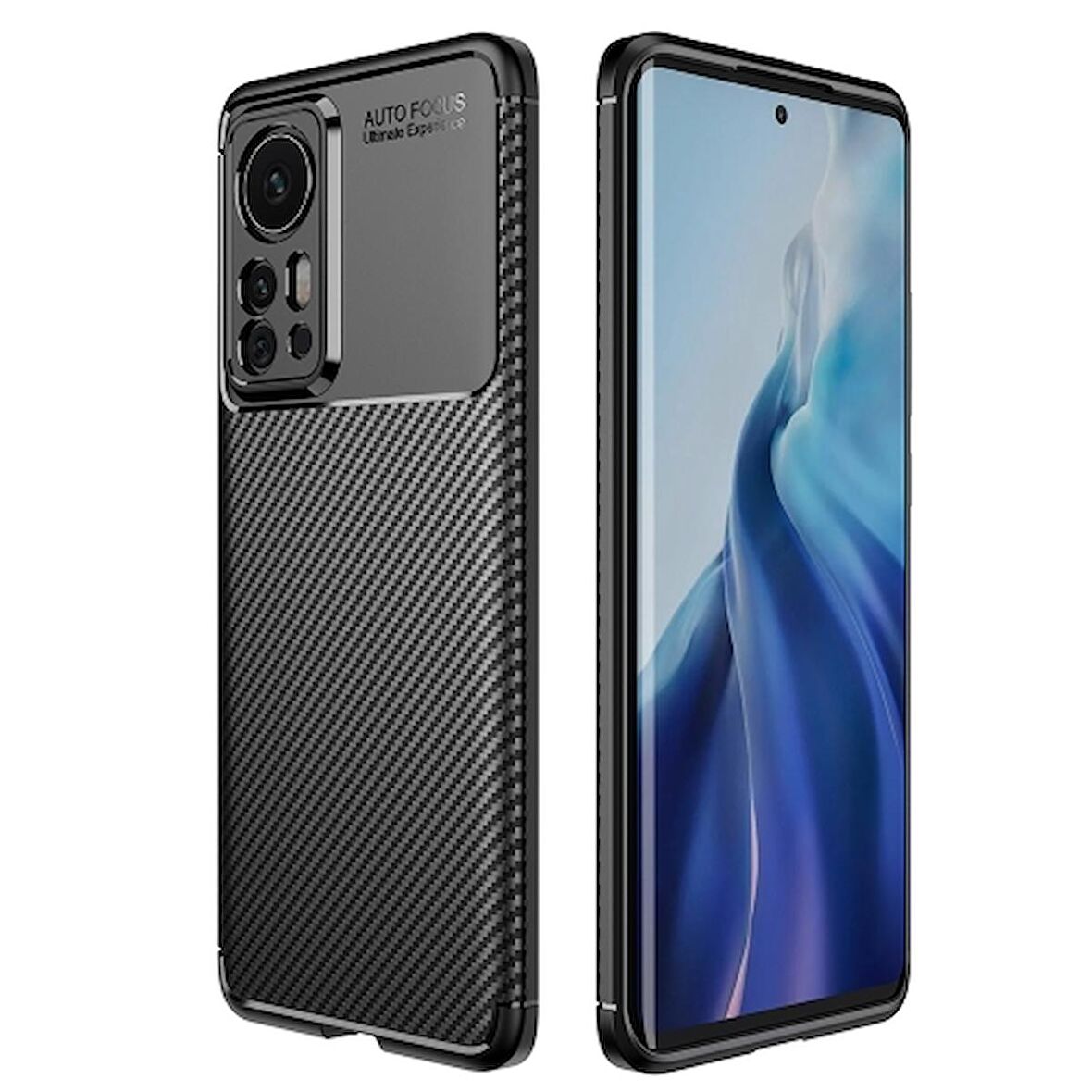 Smcase Xiaomi 12 Kılıf Kamera Korumalı Negro Karbon Dokulu Silikon