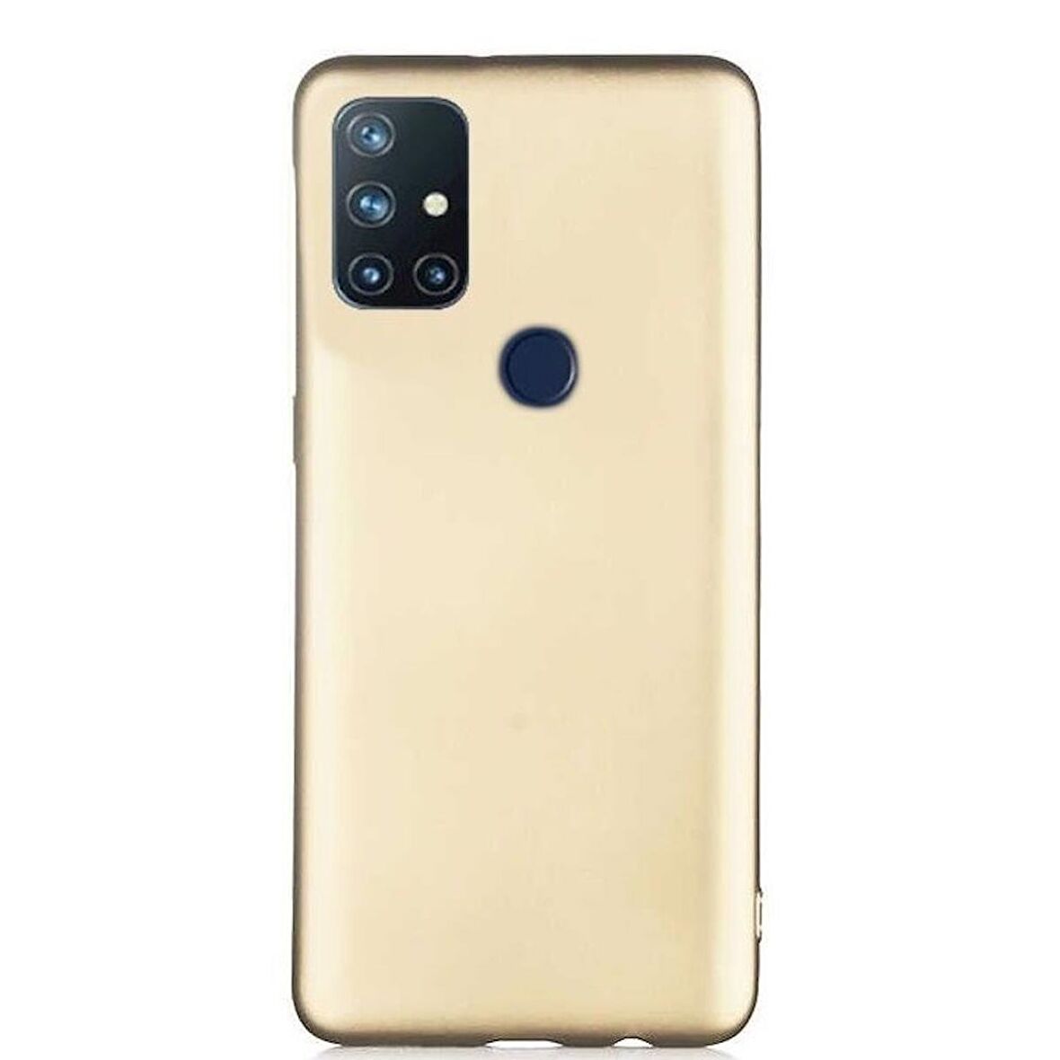 Smcase OnePlus Nord N10 5G Kılıf Lüks Premier Silikon