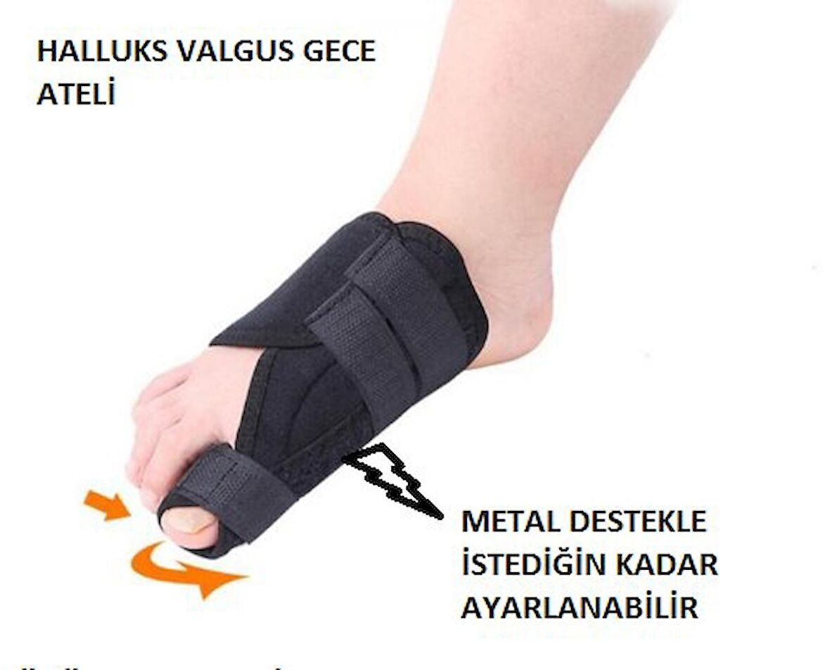 Ayak Baş Parmak Halluks Valgus Gece Ateli Kemik Düzeltici Bunyon