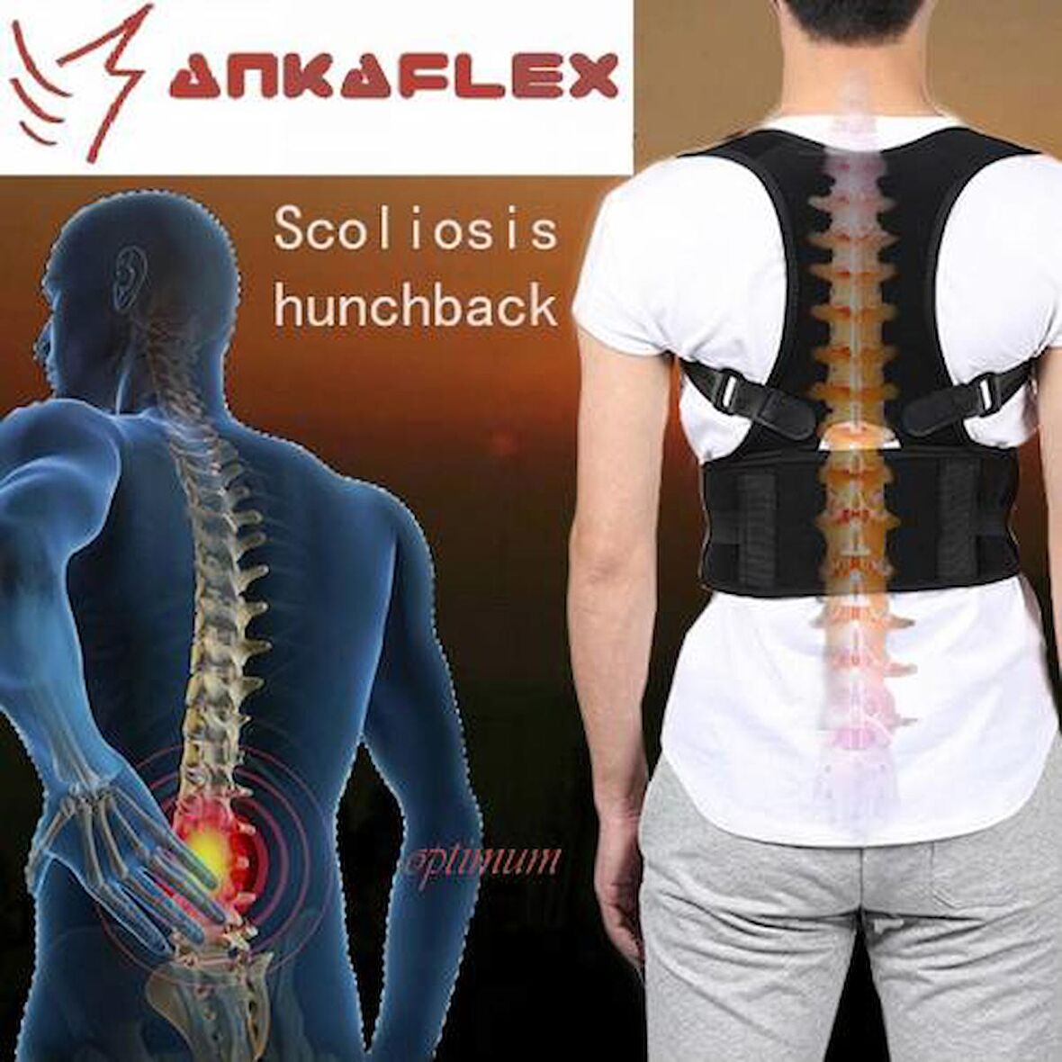 Ankaflex Medikal Kifoz Korsesi Skolyoz Korsesi Dik Duruş Korsesi