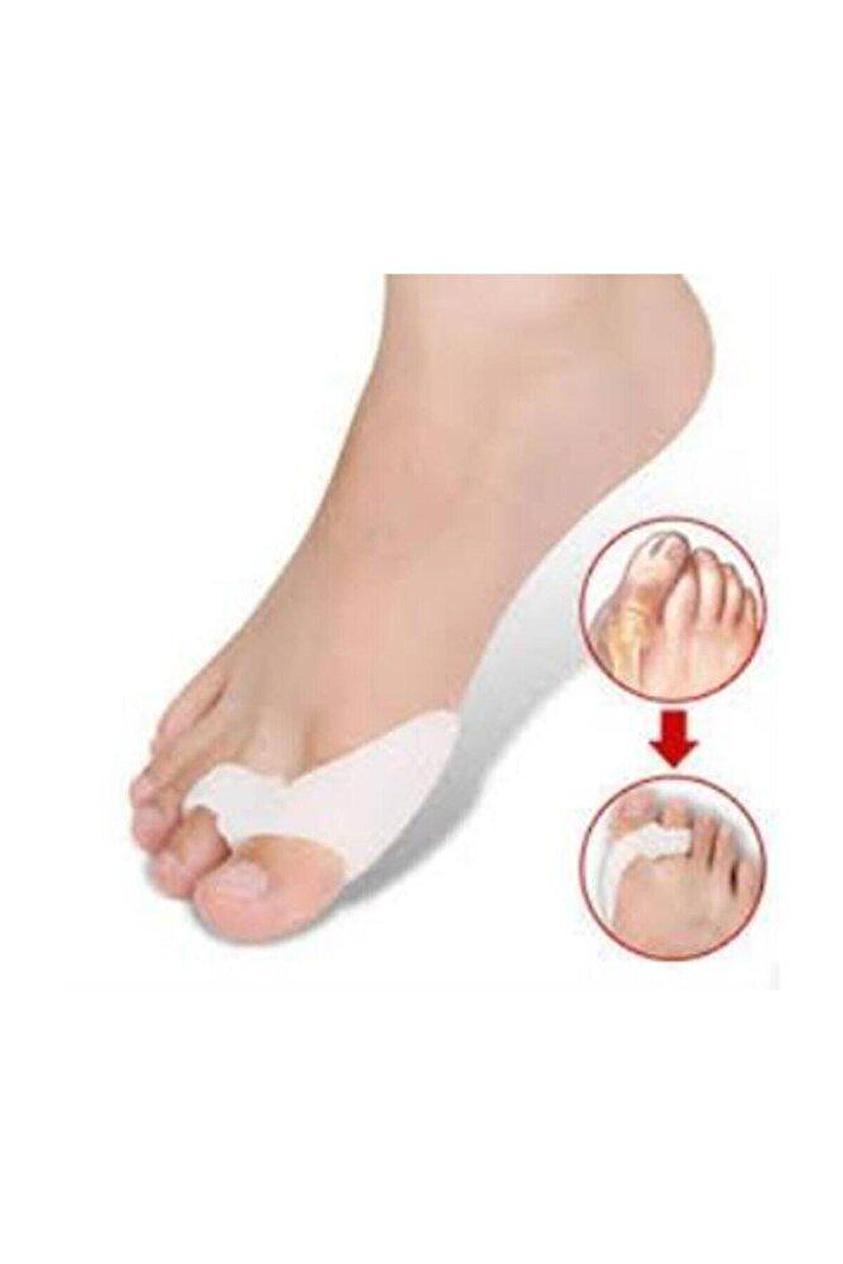 Orta Parmağa Geçen Metatarsal Pad