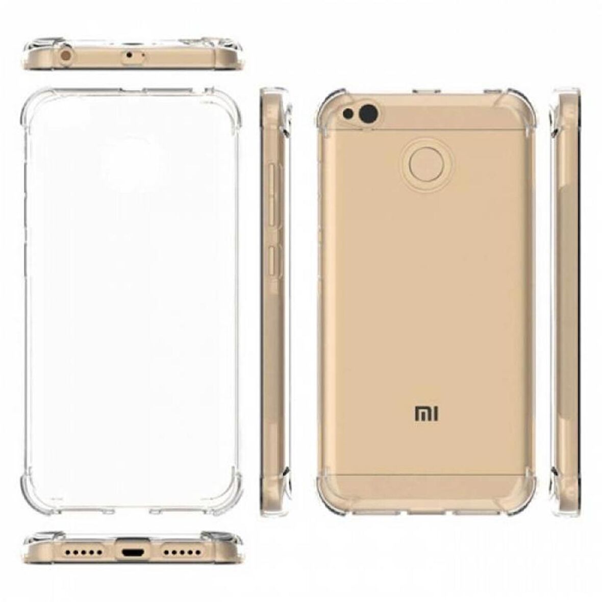Gpack Xiaomi RedMi 4X Kılıf AntiShock Ultra Koruma