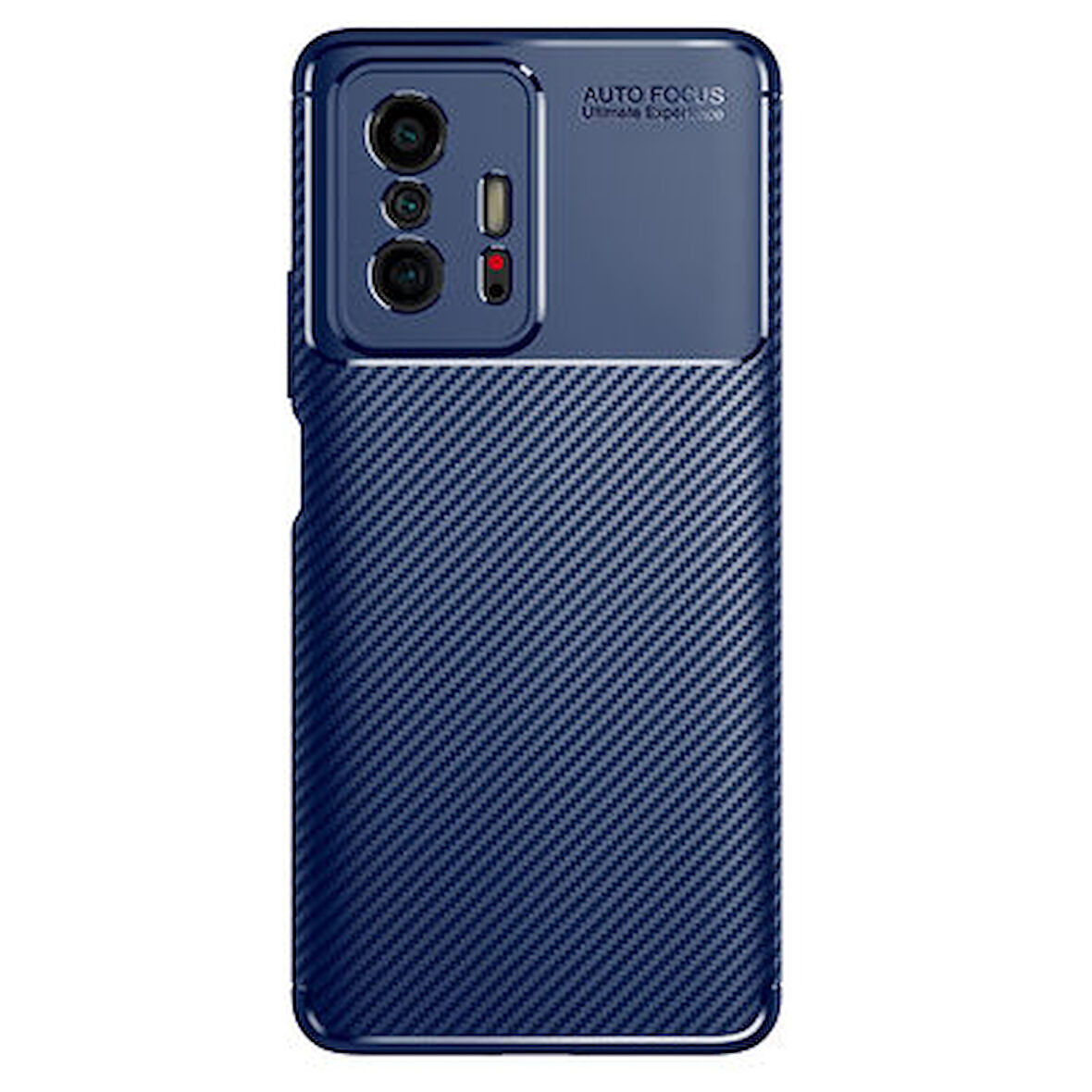 Xiaomi Mi 11T 5G Kılıf Karbon Desenli Şık Tamia Premium Silikon Kapak