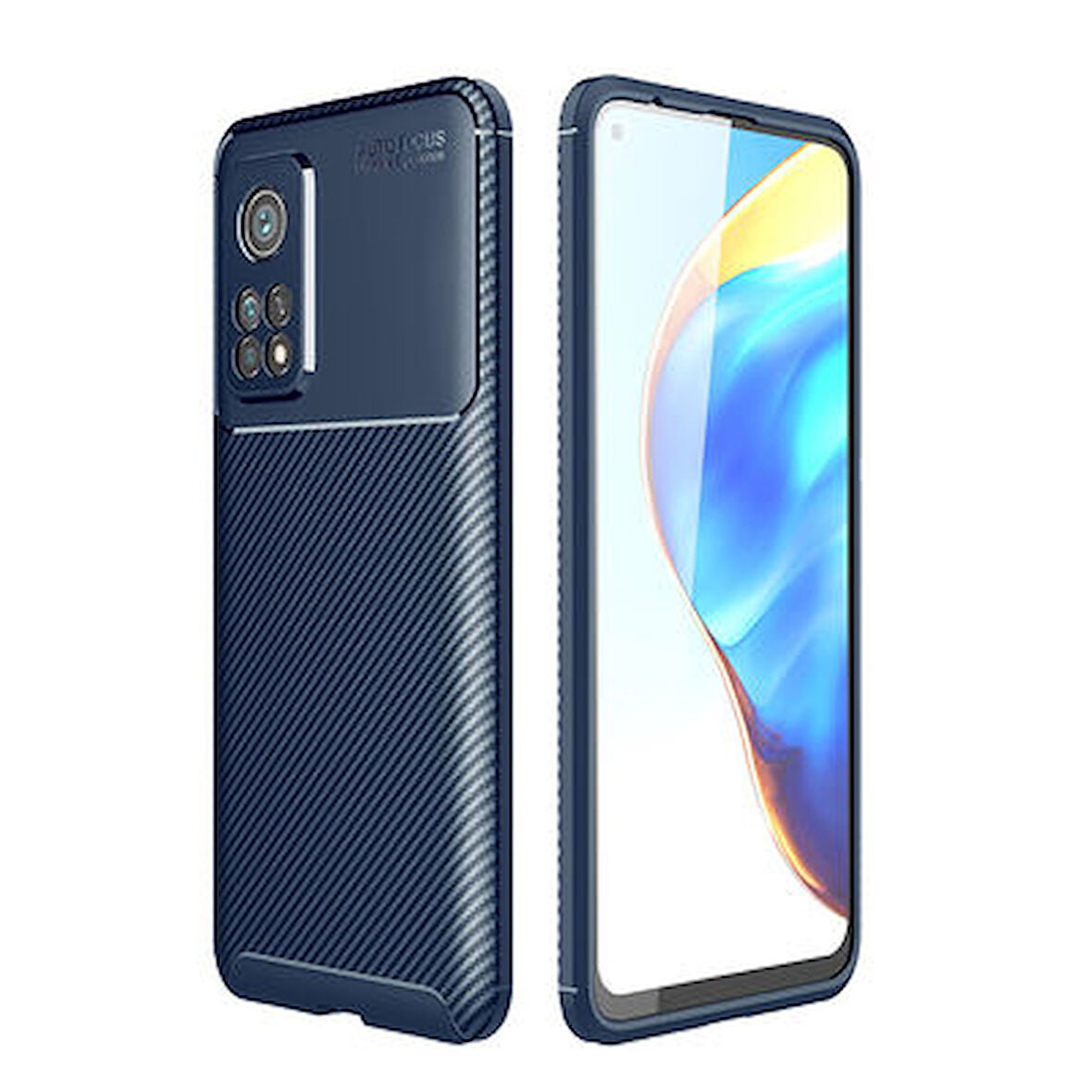 Xiaomi Mi 10T Pro 5G Kılıf Karbon Desenli Esnek Yüksek Kaliteli Meteryalden Üretilmiş Silikon Kapak RYC/Negro