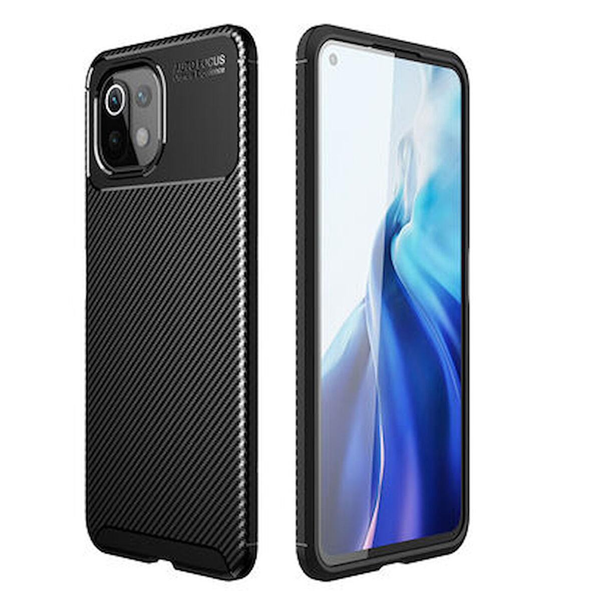 Xiaomi Mi 11 Lite Kılıf Karbon Desenli Şık Tamia Premium Silikon Kapak