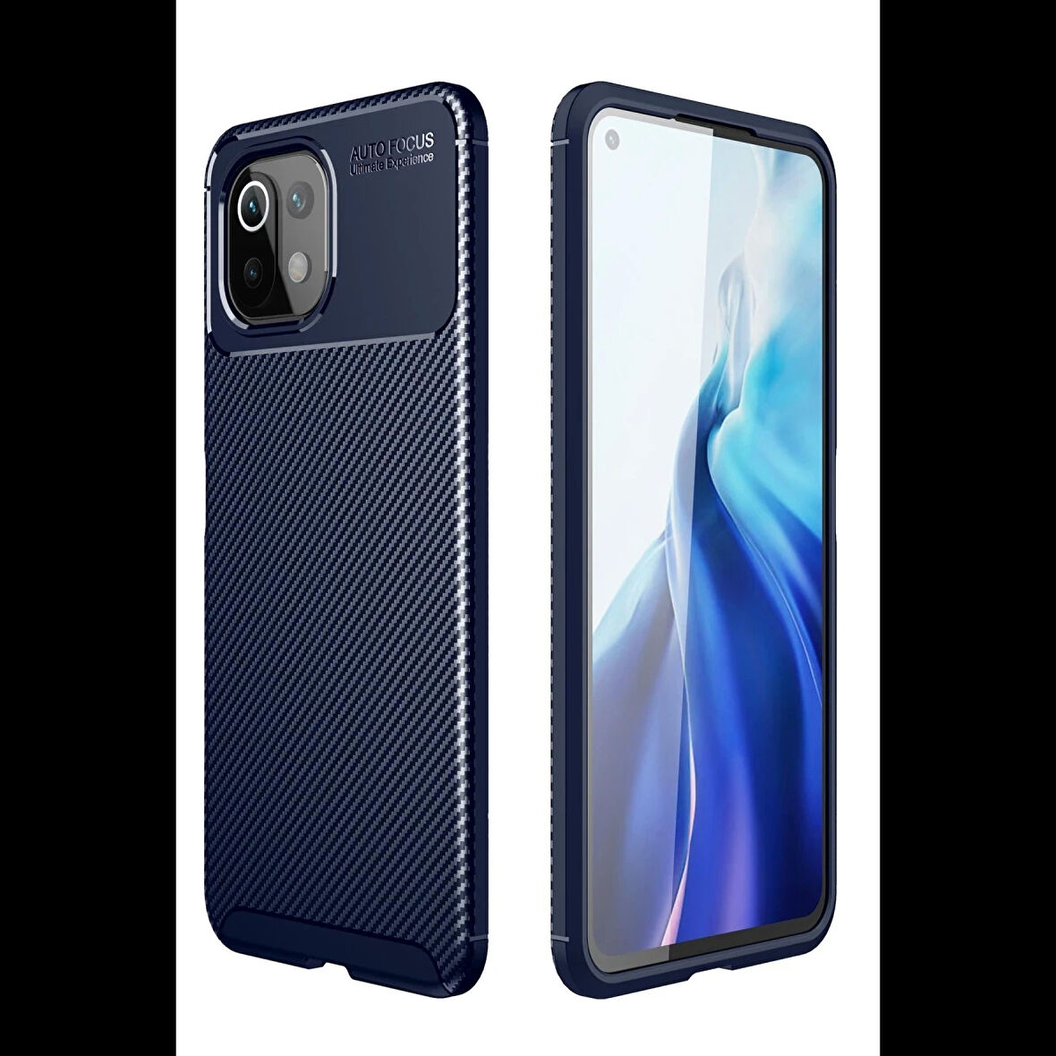 Newface Xiaomi Uyumlu Mİ 11 Lite Kılıf Auto Focus Karbon Kapak