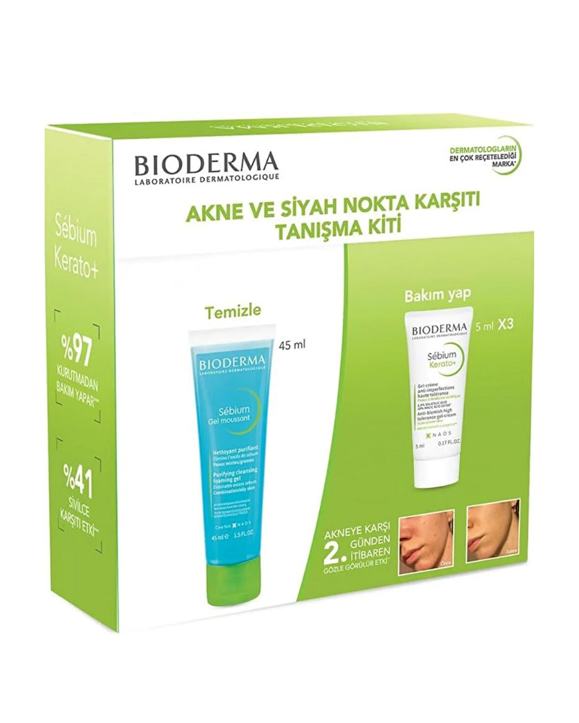 Bioderma Akne ve Siyah Nokta Karşıtı Tanışma Kiti