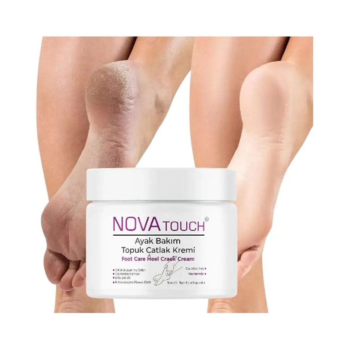 Nova Touch Ayak Ve Topuk Çatlak Kremi