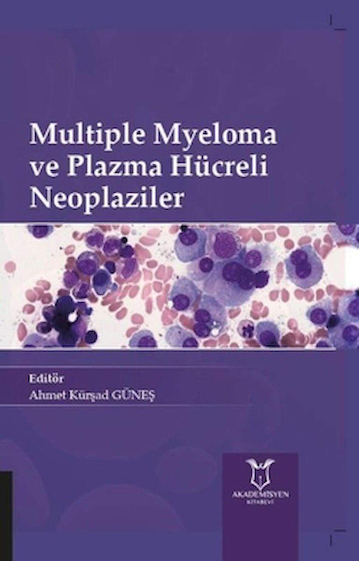 Multiple Myeloma ve Plazma Hücreli Neoplaziler