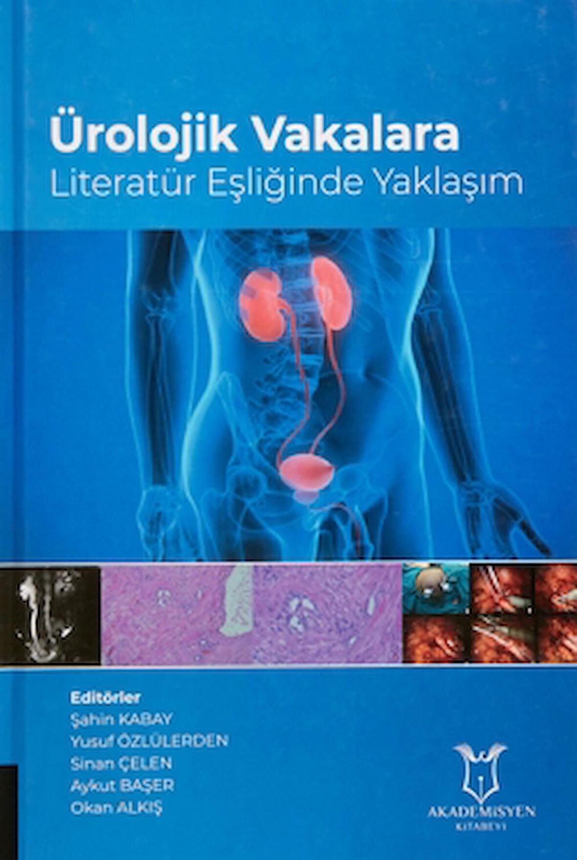 Ürolojik Vakalara Literatür Eşliğinde Yaklaşım