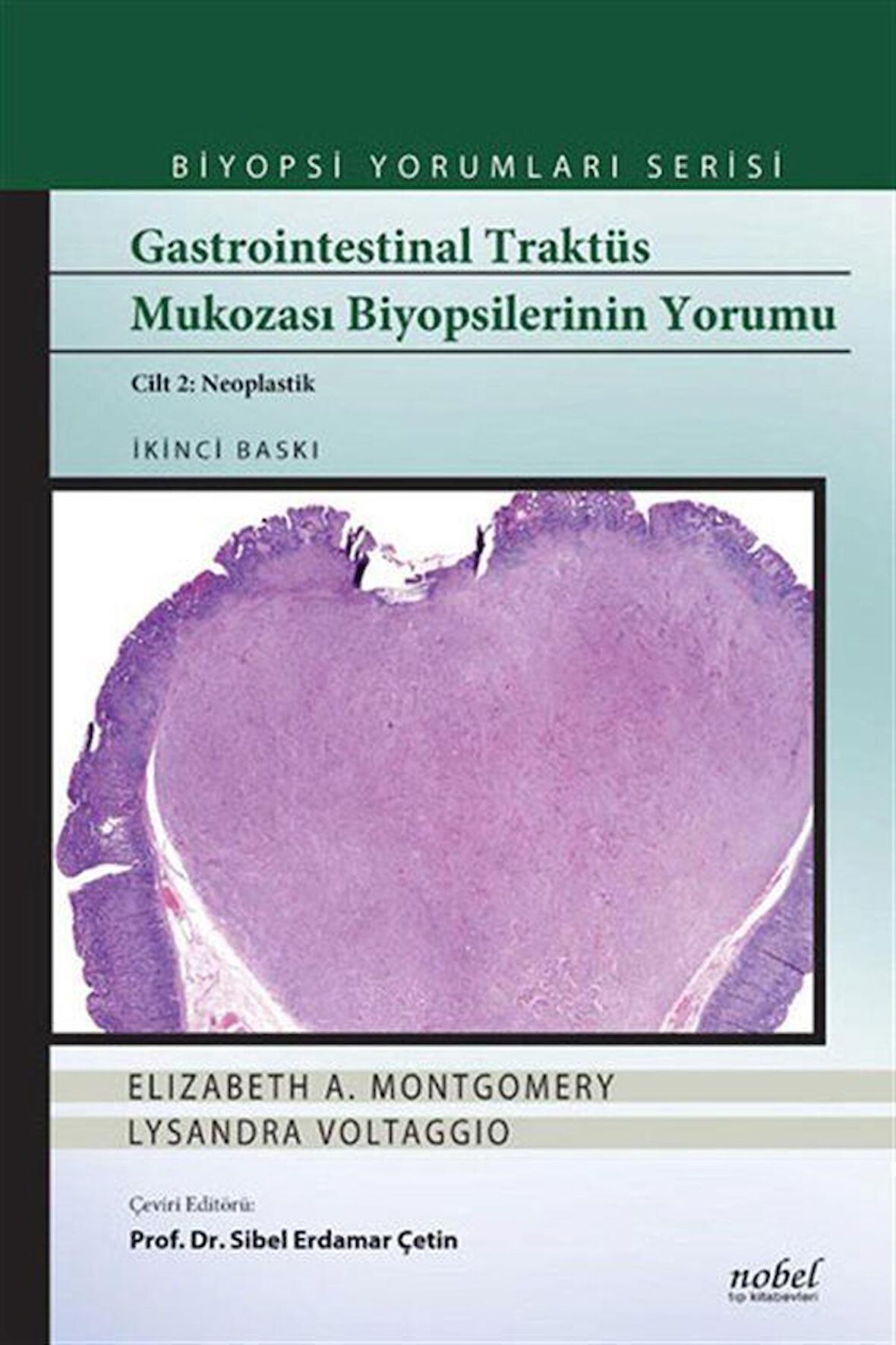Gastrointestinal Traktüs Mukozası Biyopsilerinin Yorumu (Cilt 2 Neoplastik)
