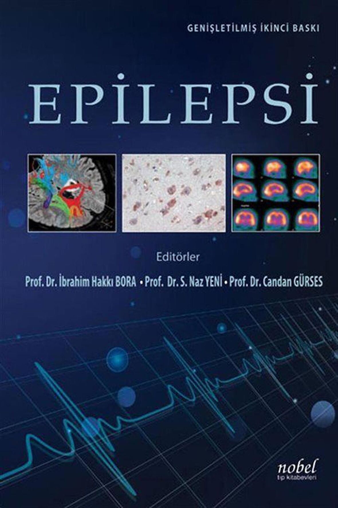 Epilepsi
