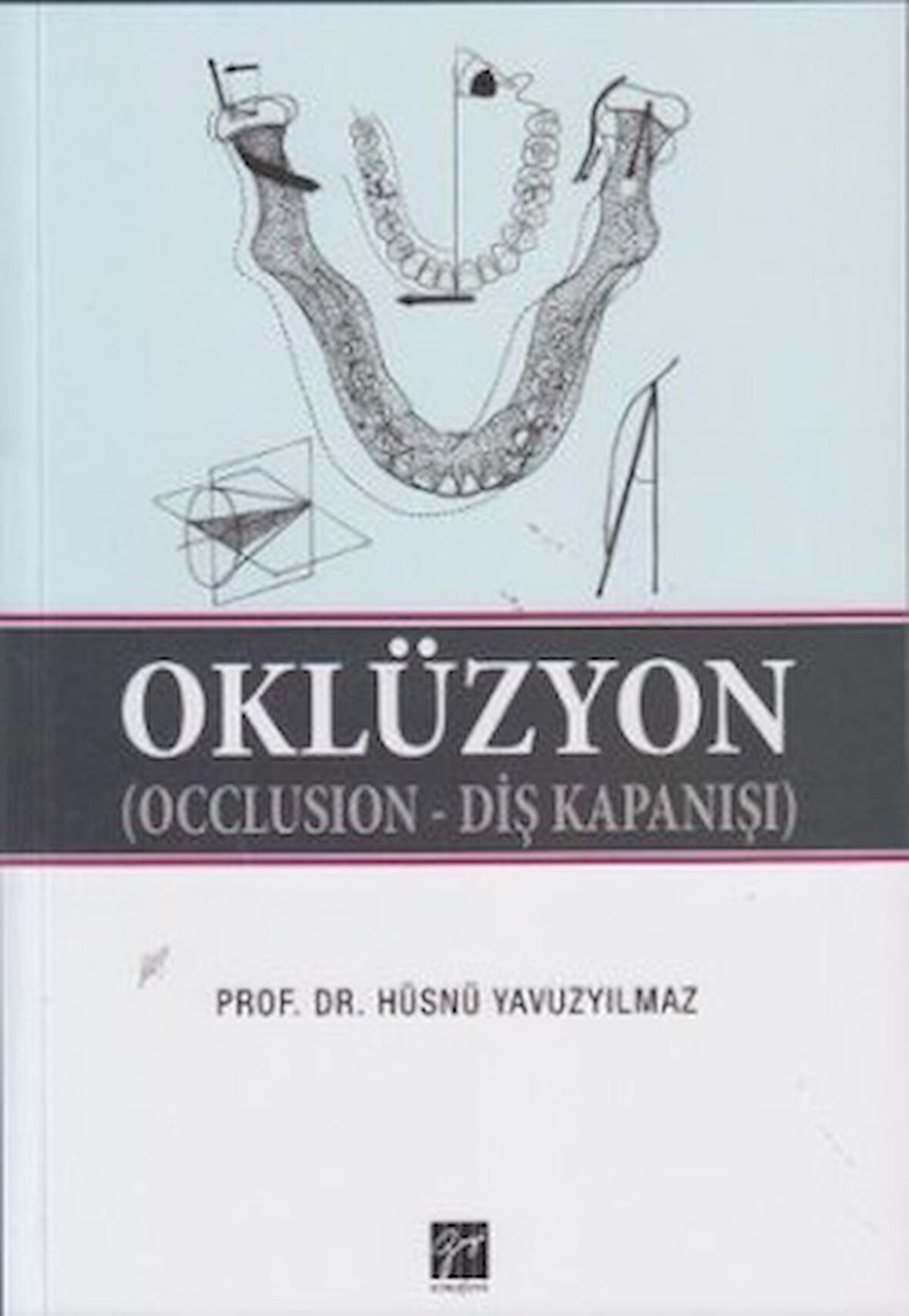 Oklüzyon