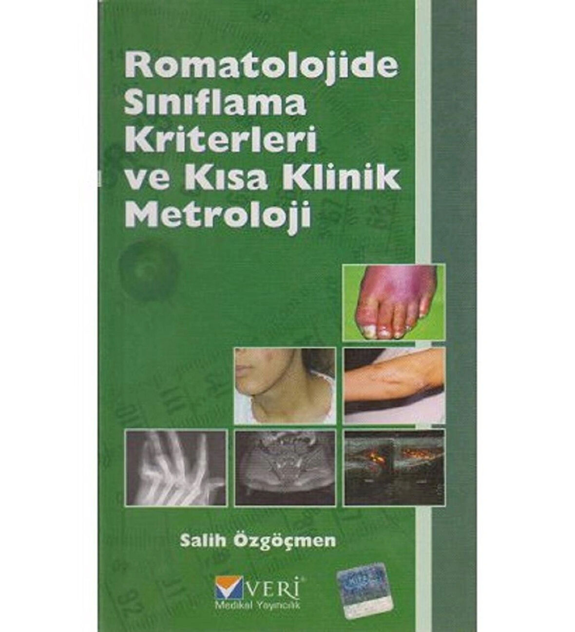 Romatolojide Sınıflama Kriterleri ve Kısa Klinik Metroloji