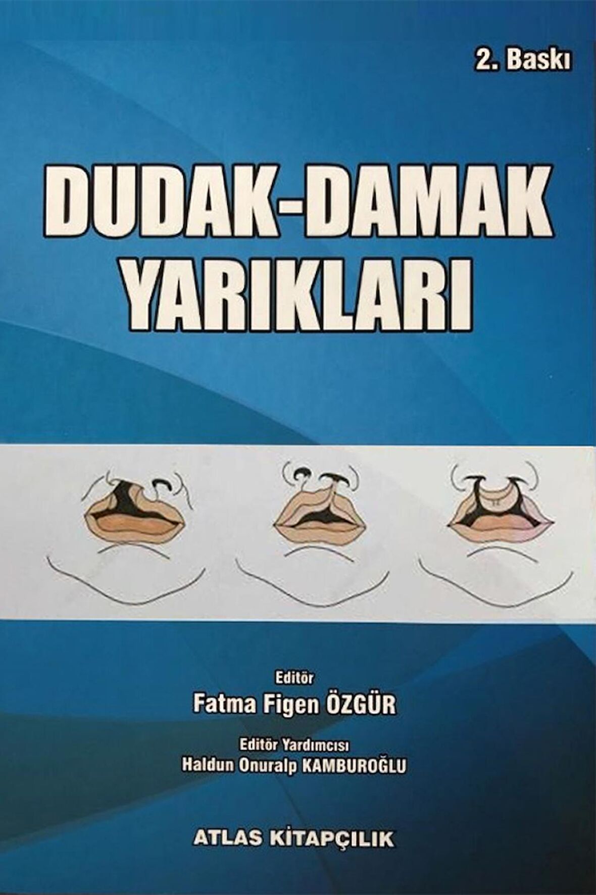 Dudak Damak Yarıkları