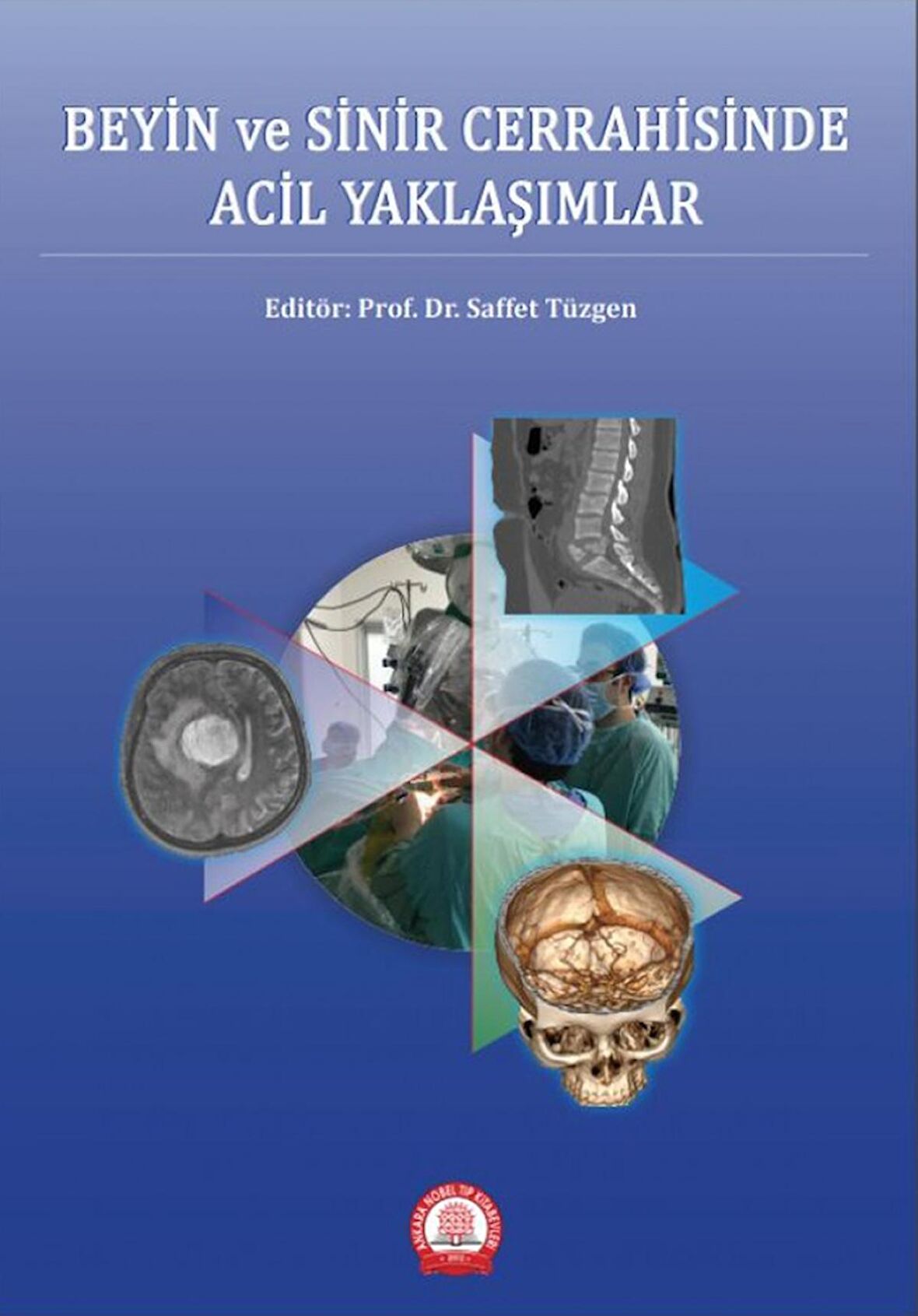 Beyin ve Sinir Cerrahisinde Acil Yaklaşımlar