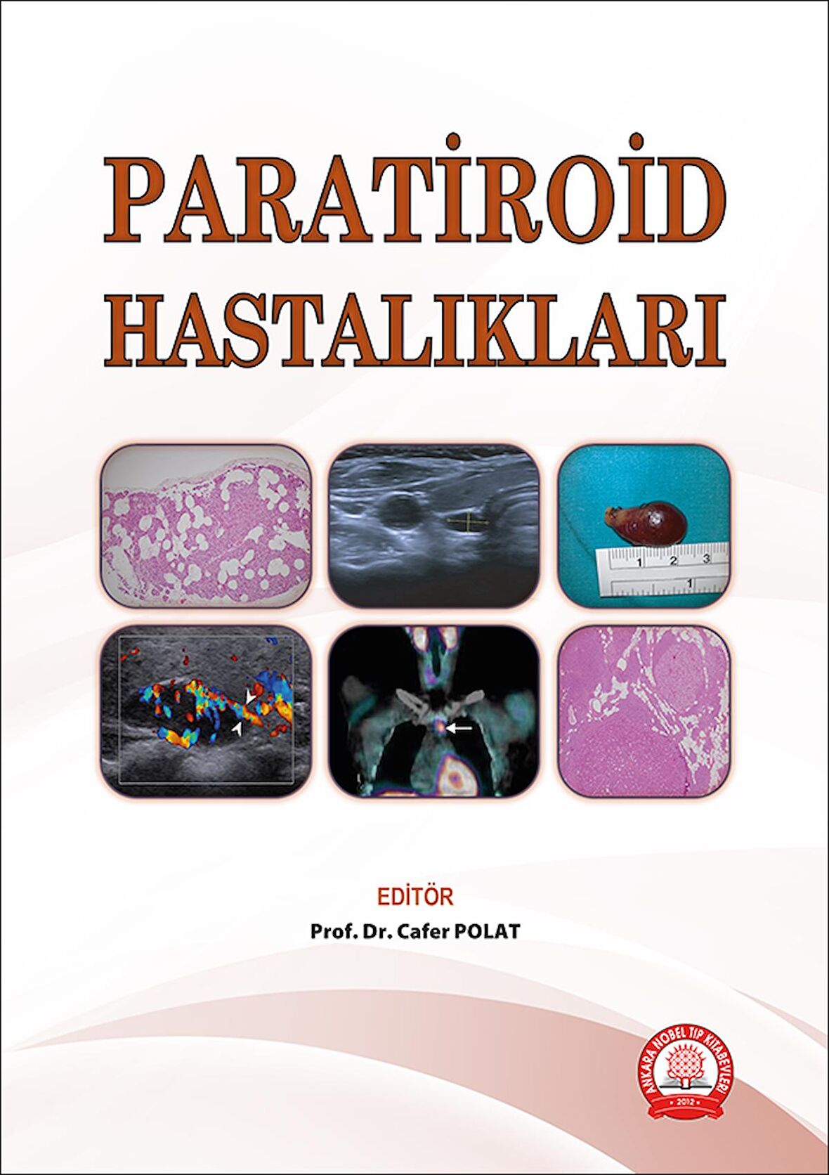 Paratiroid Hastalıkları