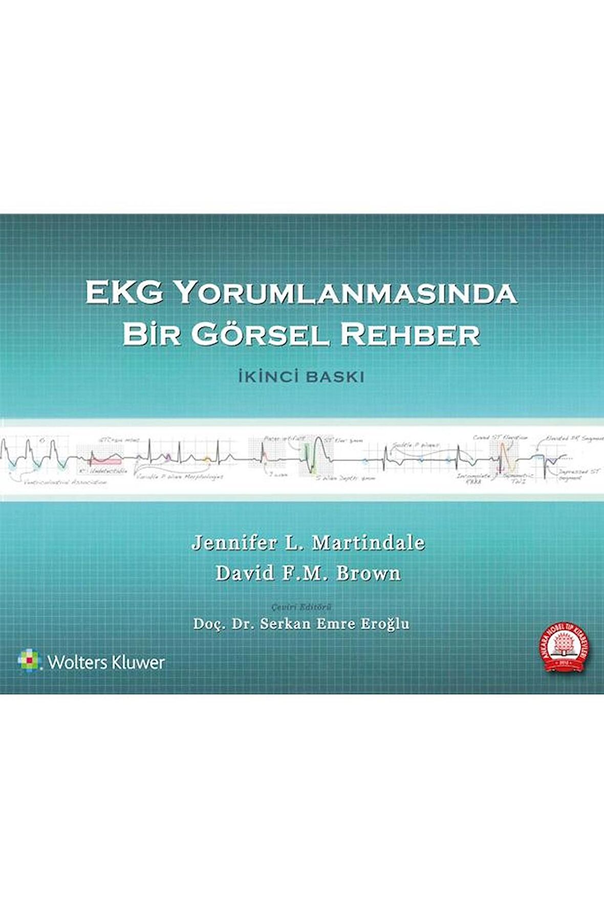 EKG Yorumlanmasında Bir Görsel Rehber