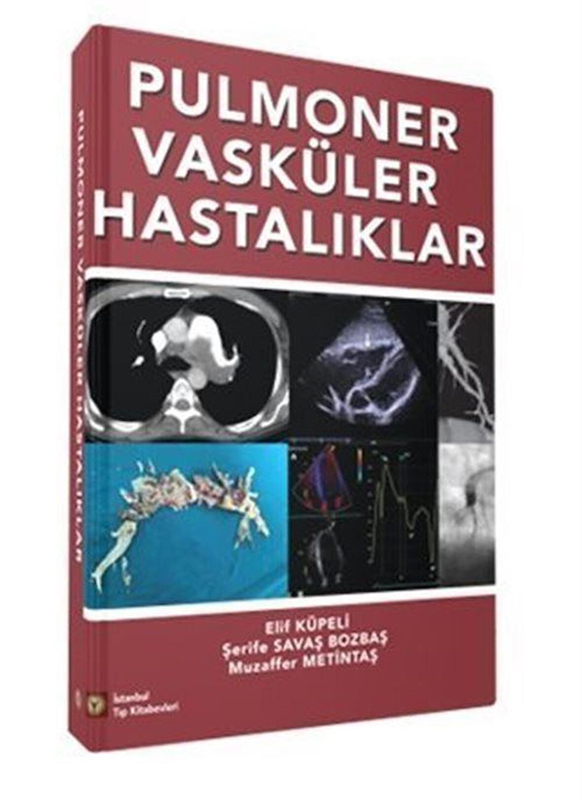 Pulmoner Vasküler Hastalıklar