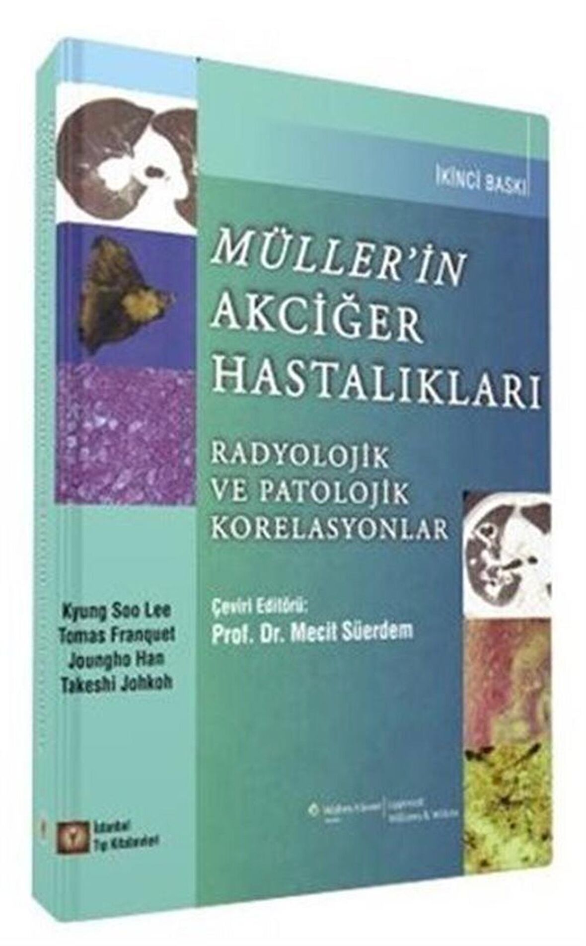 Müller’in Akciğer Hastalıkları