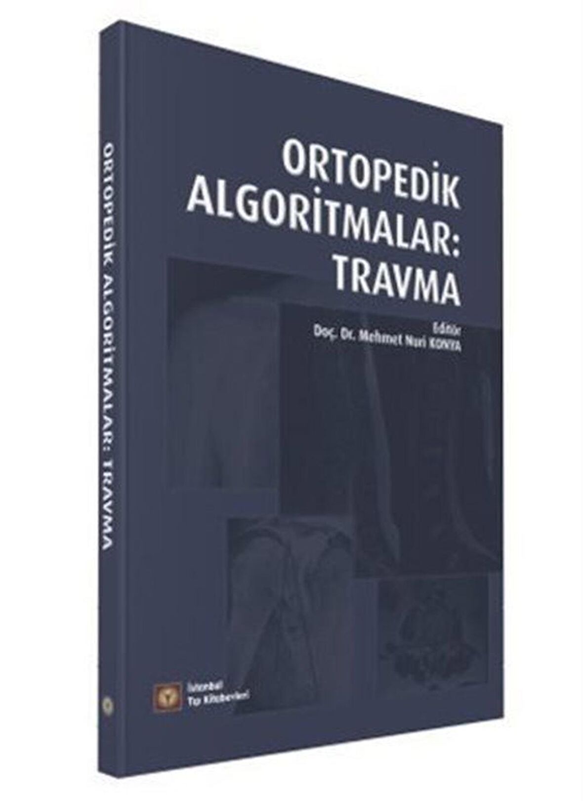 Ortopedik Algoritmalar: Travma