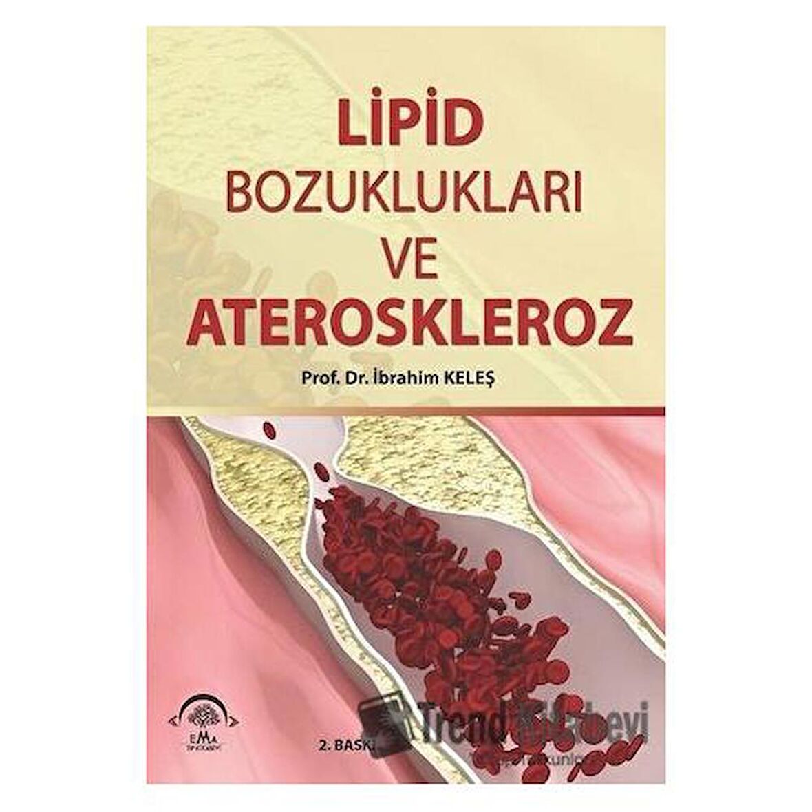 Lipid Bozuklukları ve Ateroskleroz