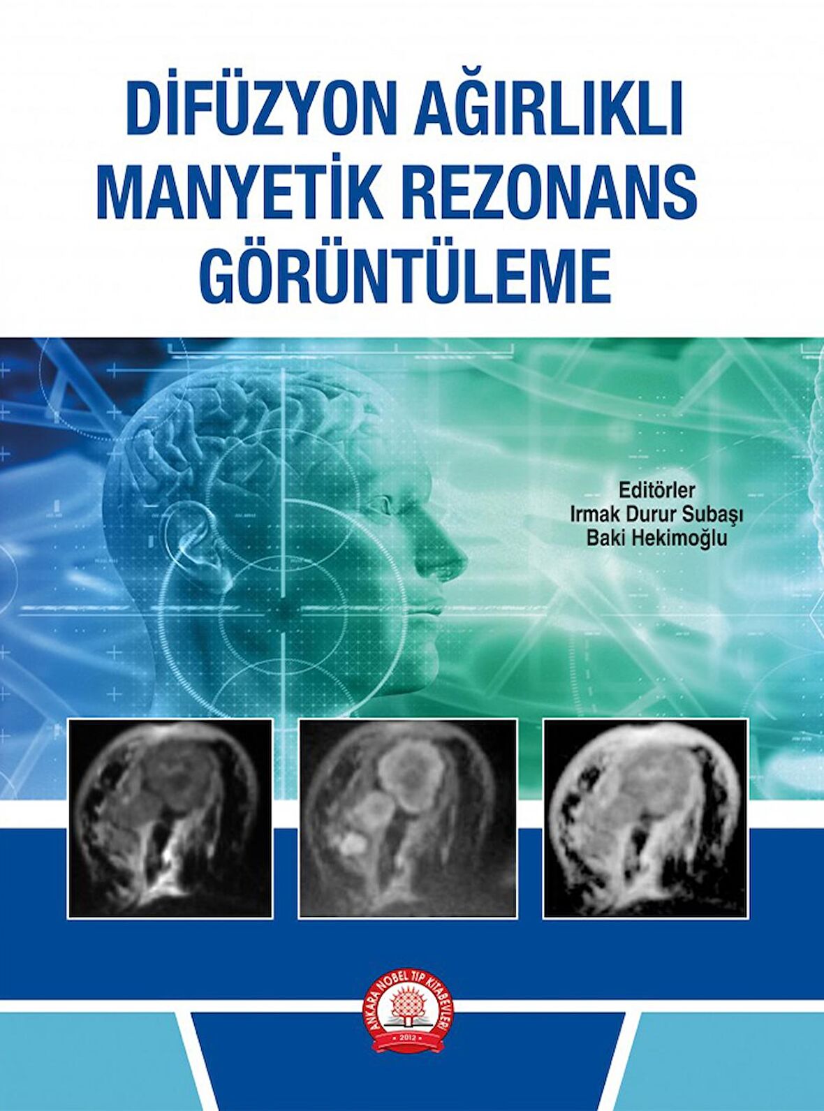 Difüzyon Ağırlıklı Manyetik Rezonans Görüntüleme