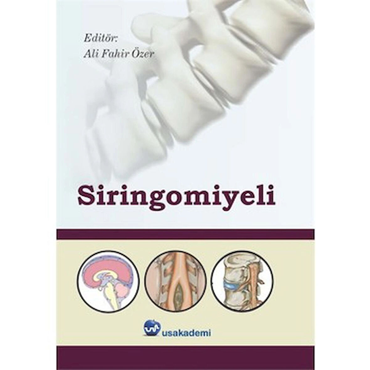 Siringomiyeli