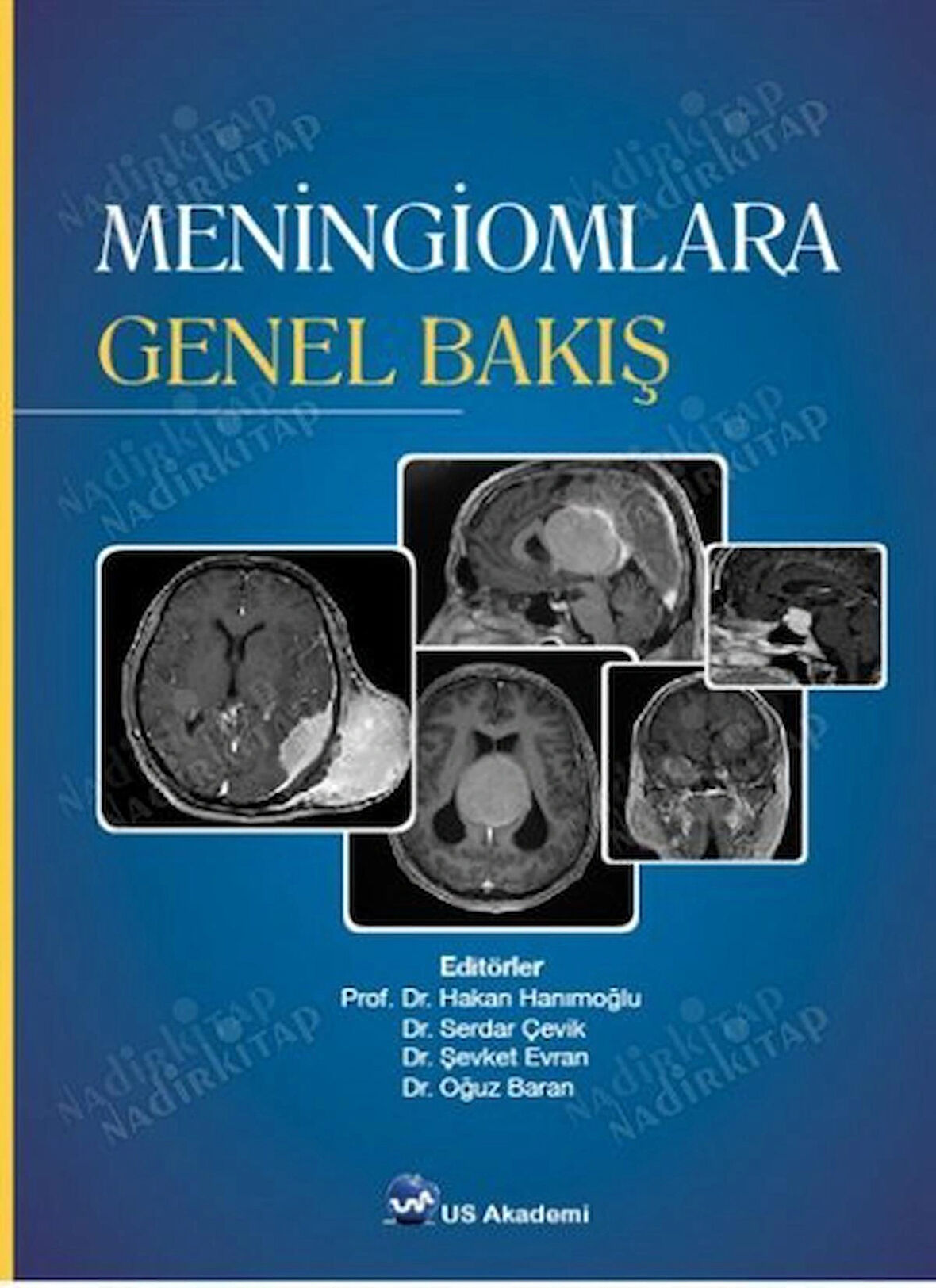 Meningiomlara Genel Bakış