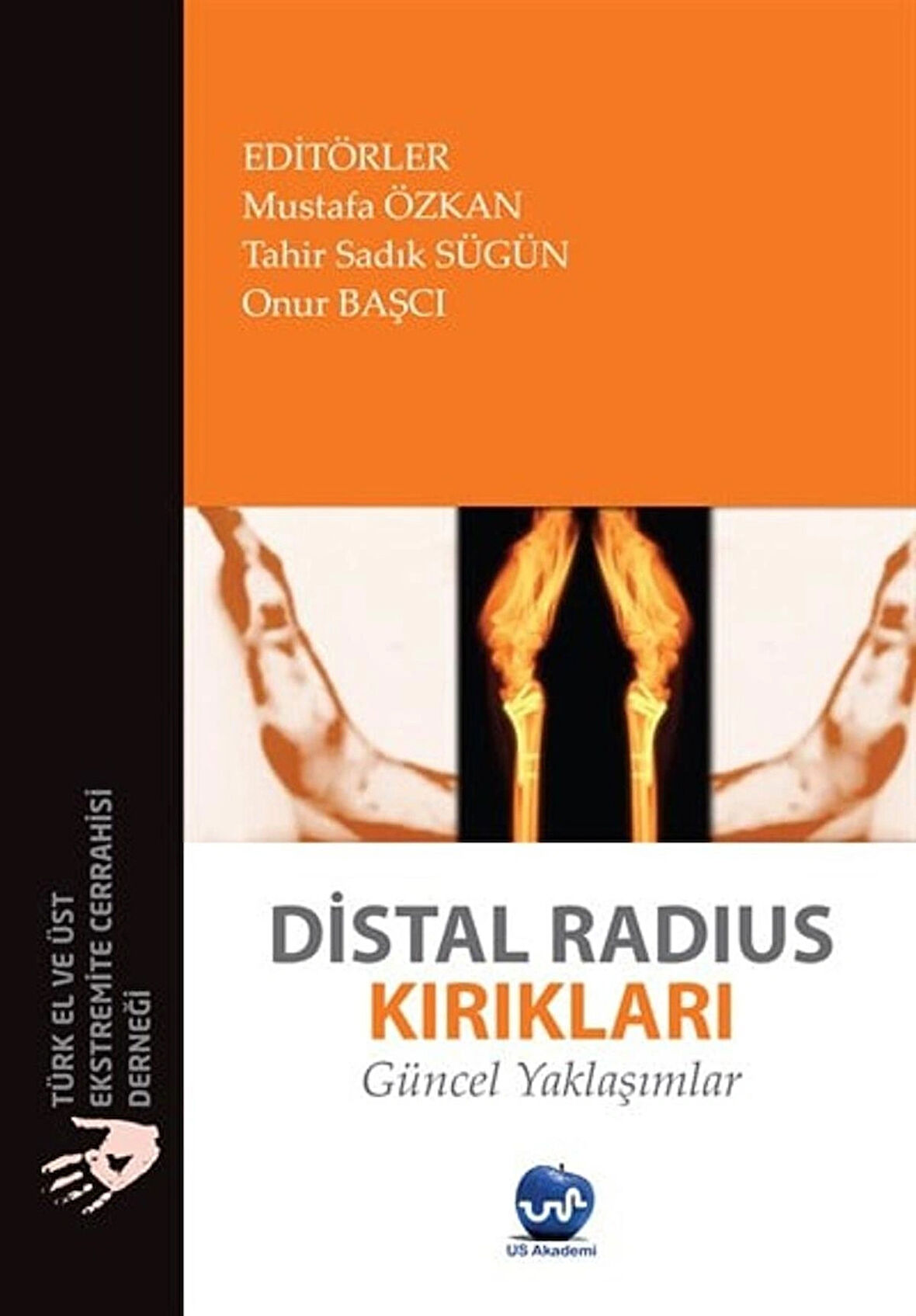 Distal Radius Kırıkları Güncel Yaklaşımlar