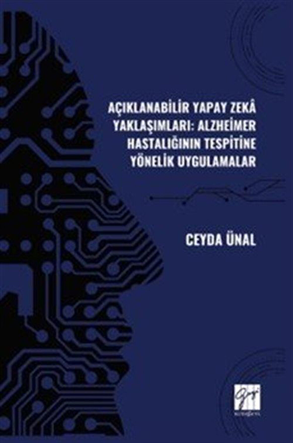 Açıklanabilir Yapay Zeka Yaklaşımları: Alzheimer Hastalığının Tespitine Yönelik Uygulamalar / Ceyda Ünal