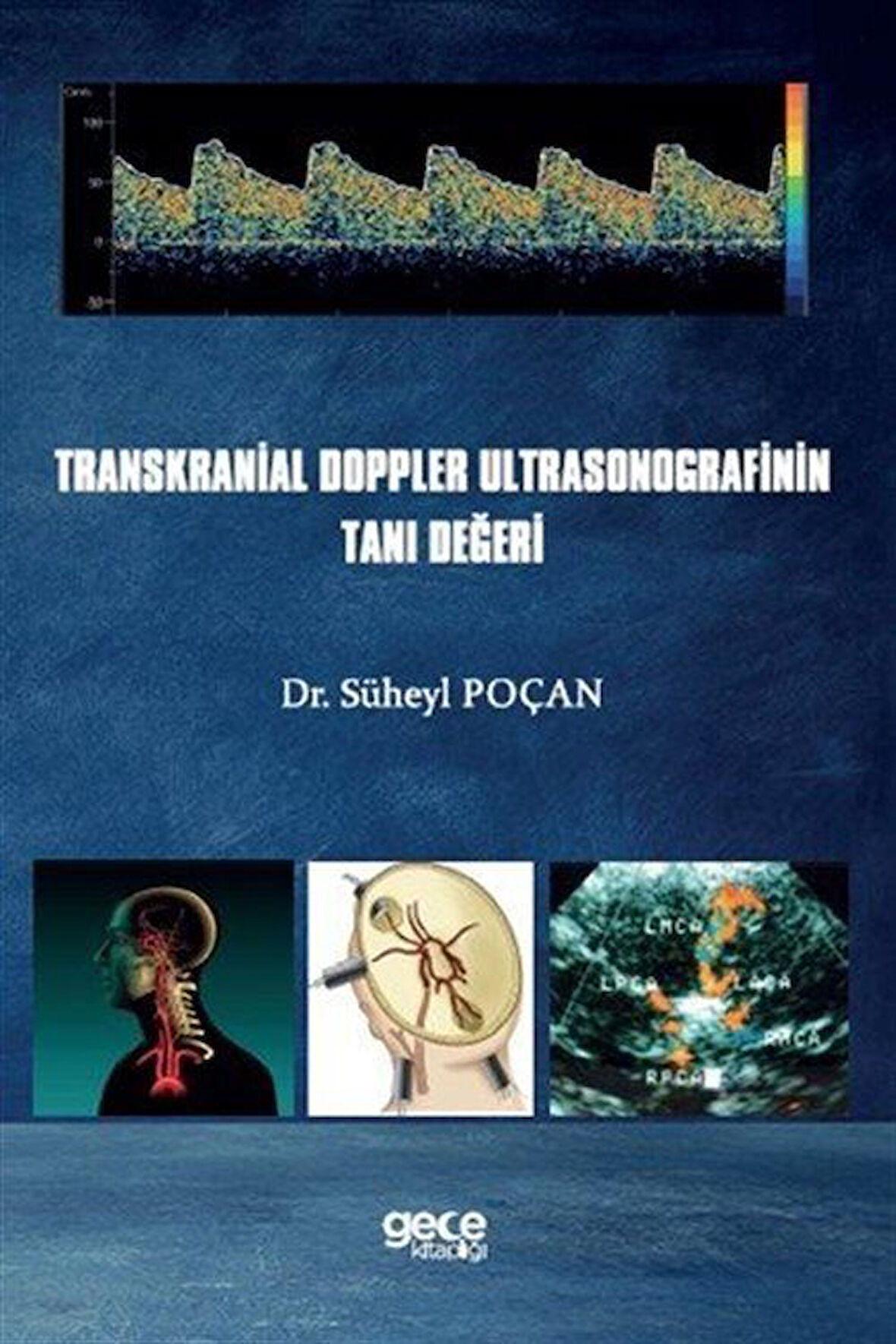 Transkranial Doppler Ultrasonografinin Tanı Değeri / Dr. Süheyl Poçan