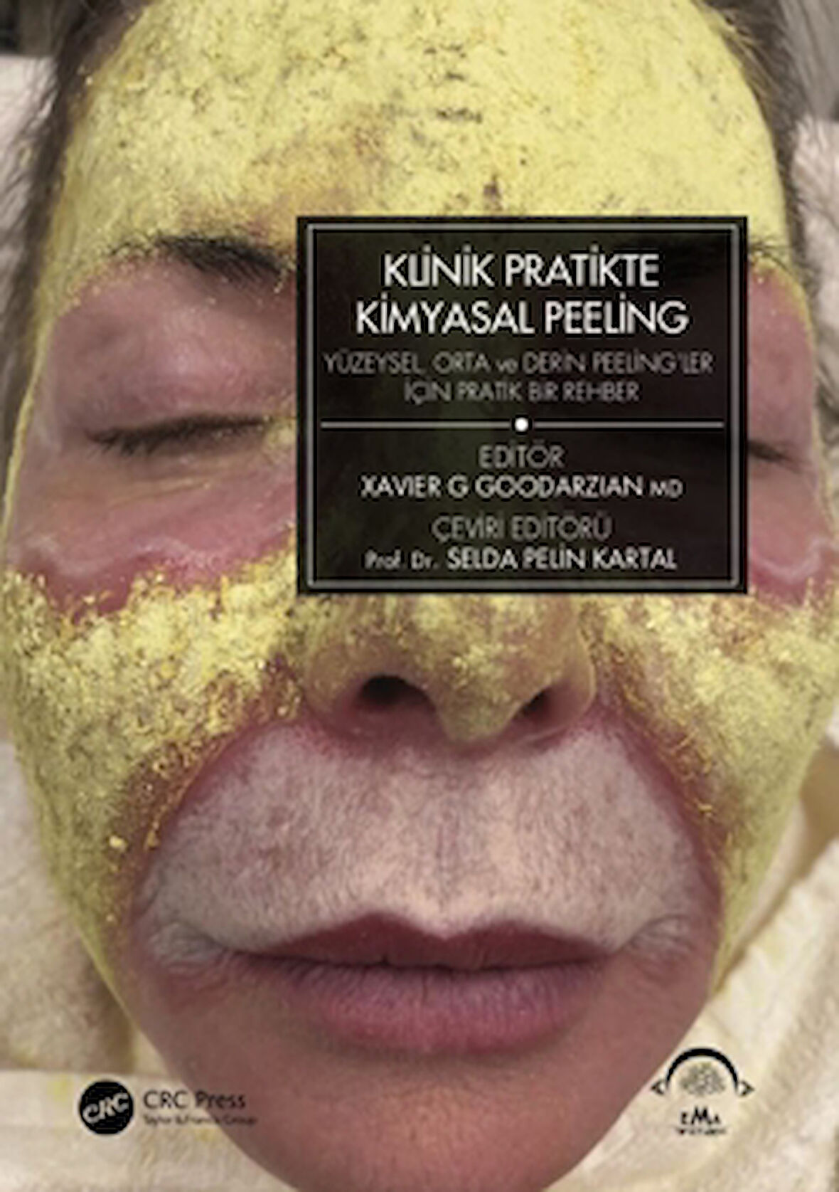 Klinik Pratikte Kimyasal Peeling