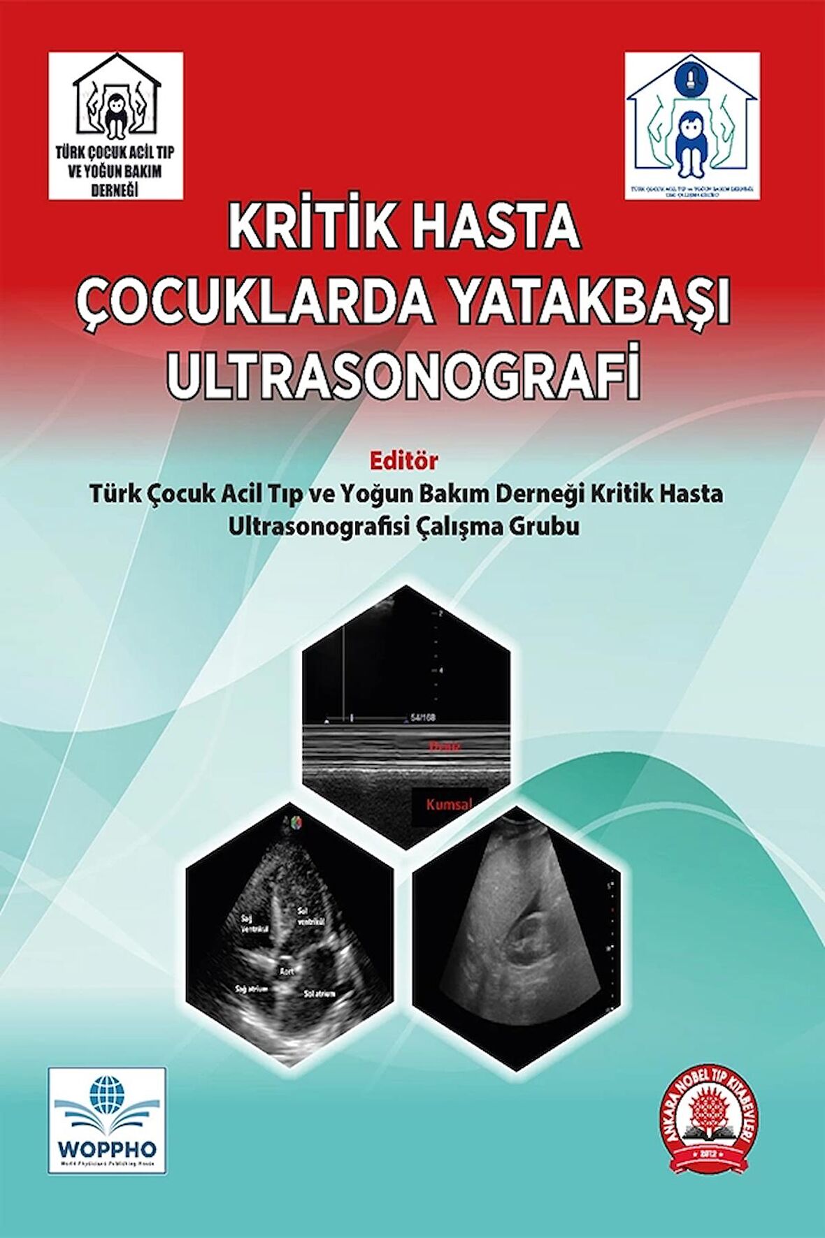 Kritik Hasta Çocuklarda Yatakbaşı Ultrasonografi