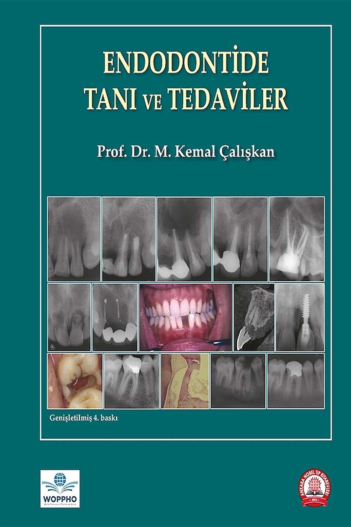 Endodontide Tanı ve Tedaviler