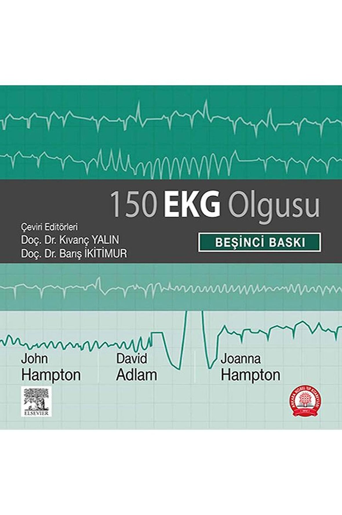 150 EKG Olgusu