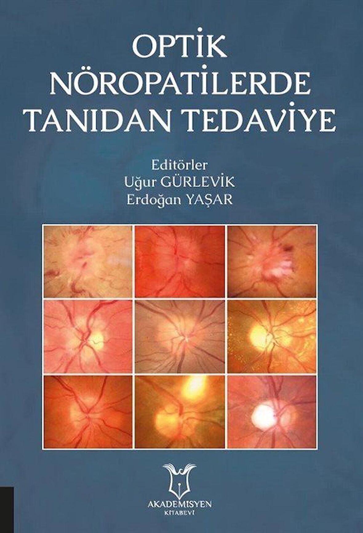 Optik Nöropatilerde Tanıdan Tedaviye / Kolektif
