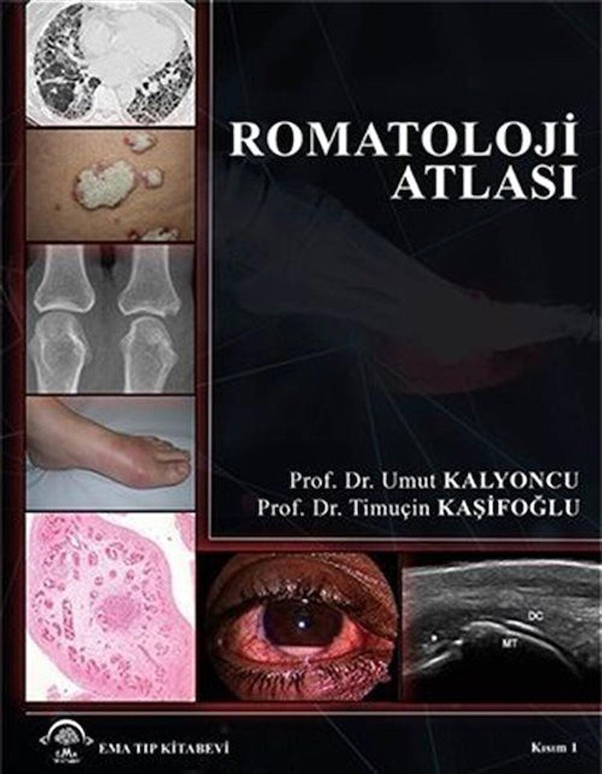 Romatoloji Atlası