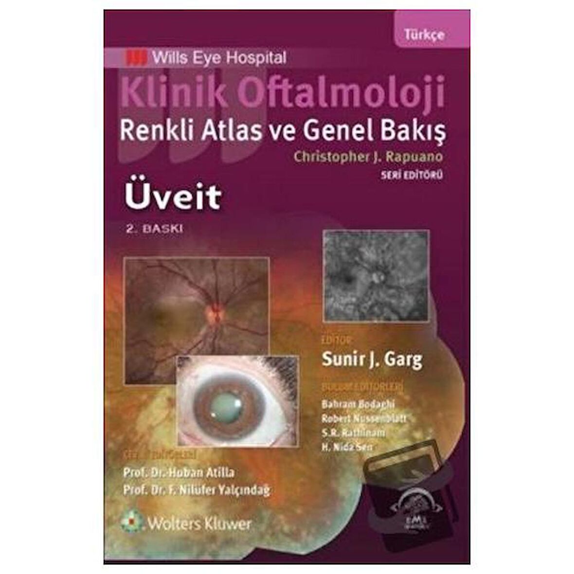 Klinik Oftalmoloji - Üveit