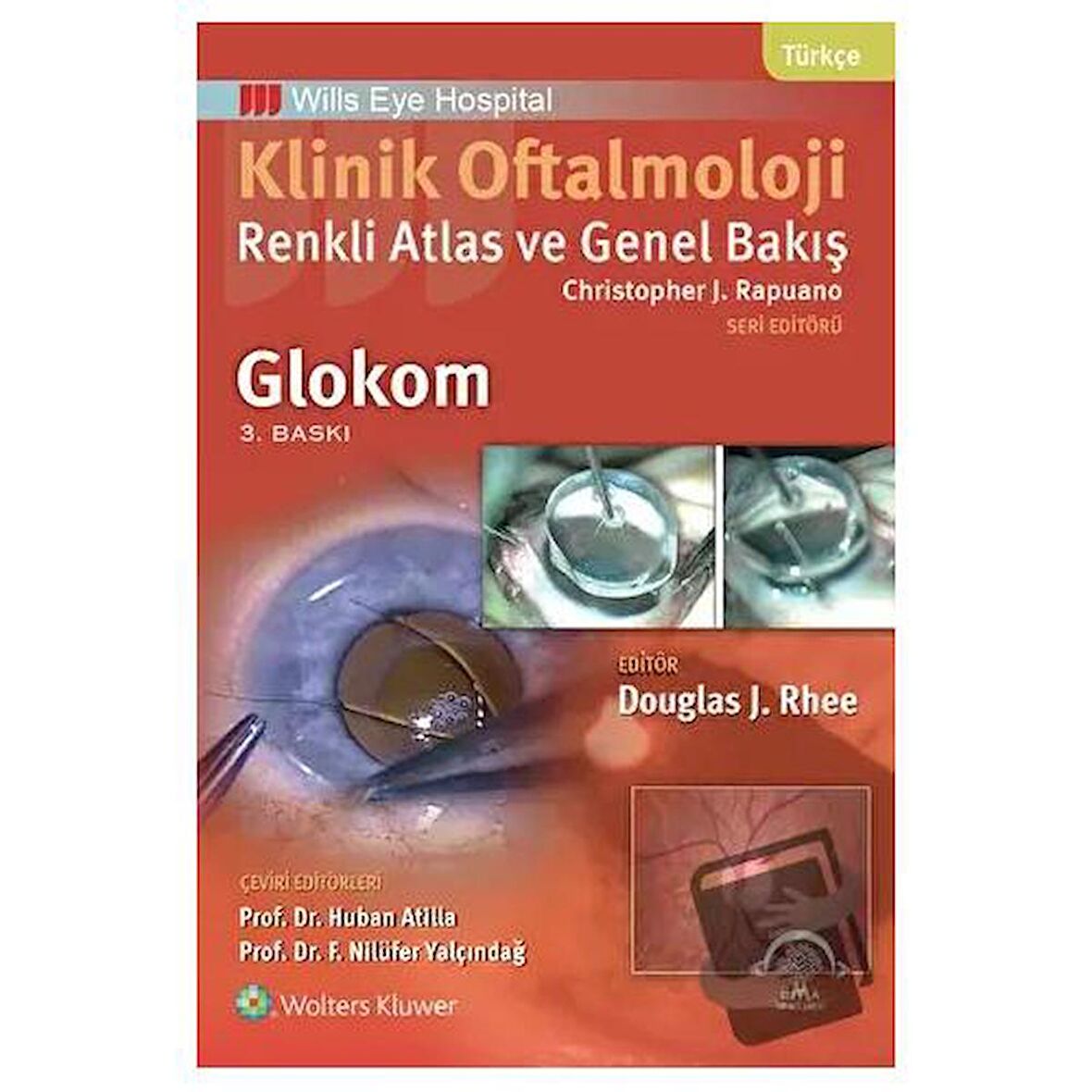 Klinik Oftalmoloji: Renkli Atlas ve Genel Bakış - Glokom