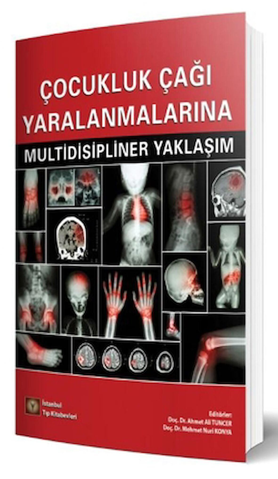 Çocukluk Çağı Yaralanmalarına Multidisipliner Yaklaşım