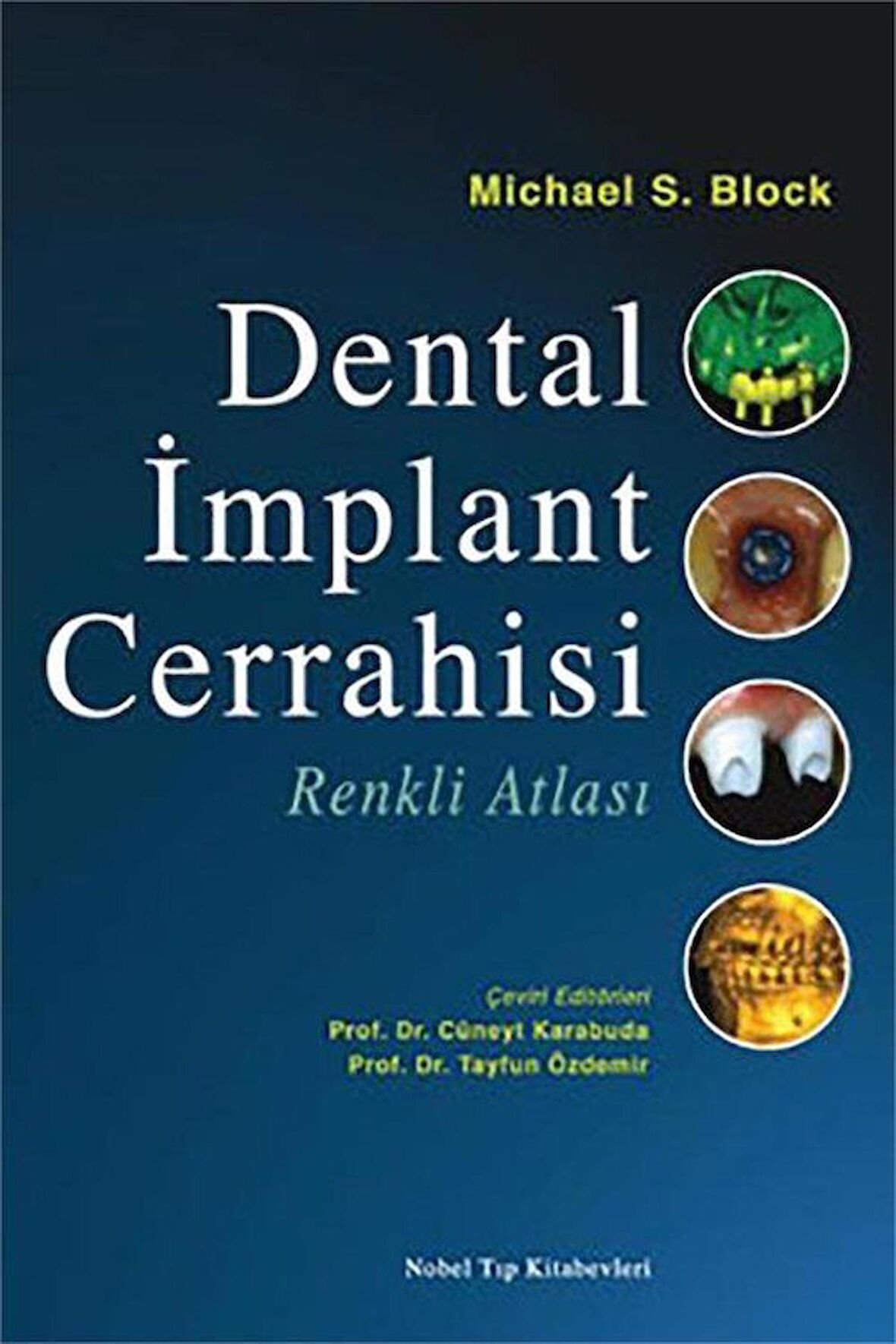 Dental İmplant Cerrahisi Renkli Atlası / Prof. Dr. Cüneyt Karabuda